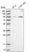 Rho GTPase Activating Protein 11A antibody, PA5-59170, Invitrogen Antibodies, Western Blot image 