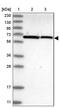 UBX Domain Protein 4 antibody, PA5-57611, Invitrogen Antibodies, Western Blot image 