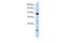 Putative ATP-dependent RNA helicase TDRD9 antibody, GTX47495, GeneTex, Western Blot image 