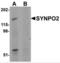 Synaptopodin 2 antibody, NBP2-82037, Novus Biologicals, Western Blot image 