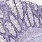 Izumo Sperm-Egg Fusion 1 antibody, HPA038104, Atlas Antibodies, Immunohistochemistry frozen image 
