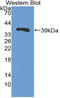 Trefoil Factor 3 antibody, LS-C296801, Lifespan Biosciences, Western Blot image 