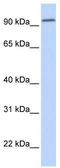 Dipeptidyl Peptidase Like 6 antibody, TA336000, Origene, Western Blot image 