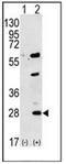 Gremlin 1, DAN Family BMP Antagonist antibody, AP51947PU-N, Origene, Western Blot image 