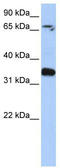 GLE1 RNA Export Mediator antibody, TA335011, Origene, Western Blot image 