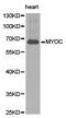 Myocilin antibody, PA5-37381, Invitrogen Antibodies, Western Blot image 
