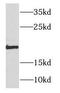 NADH:Ubiquinone Oxidoreductase Subunit B11 antibody, FNab05619, FineTest, Western Blot image 