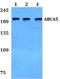 ATP Binding Cassette Subfamily A Member 5 antibody, A09348, Boster Biological Technology, Western Blot image 