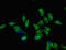 Lysosomal protective protein antibody, orb23457, Biorbyt, Immunofluorescence image 