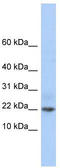 Protein FAM219A antibody, TA329767, Origene, Western Blot image 