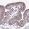 Coiled-Coil Domain Containing 113 antibody, HPA040759, Atlas Antibodies, Immunohistochemistry frozen image 
