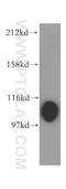 Methylenetetrahydrofolate Dehydrogenase (NADP+ Dependent) 1 Like antibody, 16113-1-AP, Proteintech Group, Western Blot image 