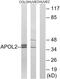 Apolipoprotein L2 antibody, GTX87407, GeneTex, Western Blot image 