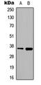 Heterogeneous Nuclear Ribonucleoprotein A2/B1 antibody, MBS8205804, MyBioSource, Western Blot image 