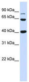 Catenin Beta 1 antibody, TA330025, Origene, Western Blot image 