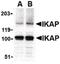 Elongator Complex Protein 1 antibody, PA5-20286, Invitrogen Antibodies, Western Blot image 