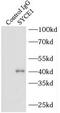 Synaptonemal Complex Central Element Protein 1 antibody, FNab08410, FineTest, Immunoprecipitation image 