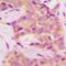 Renal carcinoma antigen NY-REN-26 antibody, orb393223, Biorbyt, Immunohistochemistry paraffin image 