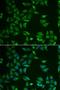 ST3 Beta-Galactoside Alpha-2,3-Sialyltransferase 4 antibody, LS-C335650, Lifespan Biosciences, Immunofluorescence image 