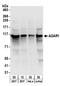 Double-stranded RNA-specific adenosine deaminase antibody, A303-884A, Bethyl Labs, Western Blot image 
