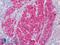 Calponin 1 antibody, LS-B4304, Lifespan Biosciences, Immunohistochemistry paraffin image 