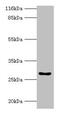 Homeobox A6 antibody, CSB-PA010656EA01HU, Cusabio, Western Blot image 