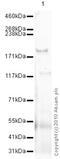 Collagen Type V Alpha 2 Chain antibody, ab7046, Abcam, Western Blot image 