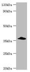 Complement Factor H Related 3 antibody, orb353096, Biorbyt, Western Blot image 