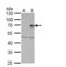 Protein Inhibitor Of Activated STAT 4 antibody, NBP1-31215, Novus Biologicals, Western Blot image 