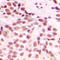 DNA Damage Inducible Transcript 3 antibody, LS-C352113, Lifespan Biosciences, Immunohistochemistry paraffin image 