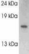 Vesicle Associated Membrane Protein 2 antibody, ab3347, Abcam, Western Blot image 