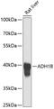 Alcohol dehydrogenase 1B antibody, GTX66246, GeneTex, Western Blot image 
