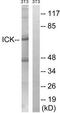 Serine/threonine-protein kinase ICK antibody, TA315191, Origene, Western Blot image 