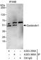 Dystrobrevin Binding Protein 1 antibody, A303-359A, Bethyl Labs, Immunoprecipitation image 