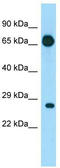 Eukaryotic translation initiation factor 4E type 1B antibody, TA334102, Origene, Western Blot image 