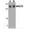 RILP-like protein 2 antibody, MBS151120, MyBioSource, Western Blot image 