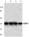 Aquaporin 5 antibody, PA5-36529, Invitrogen Antibodies, Western Blot image 