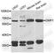 Dentin Matrix Acidic Phosphoprotein 1 antibody, A6253, ABclonal Technology, Western Blot image 