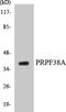 Pre-MRNA Processing Factor 38A antibody, LS-C200534, Lifespan Biosciences, Western Blot image 