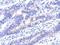 VPS33A Core Subunit Of CORVET And HOPS Complexes antibody, GTX119416, GeneTex, Immunohistochemistry paraffin image 