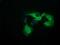 Quinolinate Phosphoribosyltransferase antibody, GTX83743, GeneTex, Immunofluorescence image 