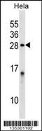 Protein phosphatase inhibitor 2 antibody, 58-236, ProSci, Western Blot image 