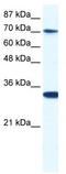 CCR4-NOT transcription complex subunit 3 antibody, TA335619, Origene, Western Blot image 
