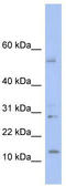 Putative TLX1 neighbor protein antibody, TA344219, Origene, Western Blot image 