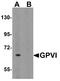 Platelet glycoprotein VI antibody, A02208, Boster Biological Technology, Western Blot image 