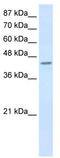 Poly(RC) Binding Protein 4 antibody, TA343896, Origene, Western Blot image 