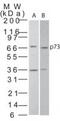 Tumor Protein P73 antibody, PA1-41565, Invitrogen Antibodies, Western Blot image 