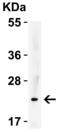 Interleukin 23 Subunit Alpha antibody, 3793, ProSci Inc, Western Blot image 