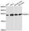 RAB7A, Member RAS Oncogene Family antibody, LS-C747860, Lifespan Biosciences, Western Blot image 