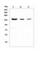 CD22 Molecule antibody, PB9691, Boster Biological Technology, Western Blot image 